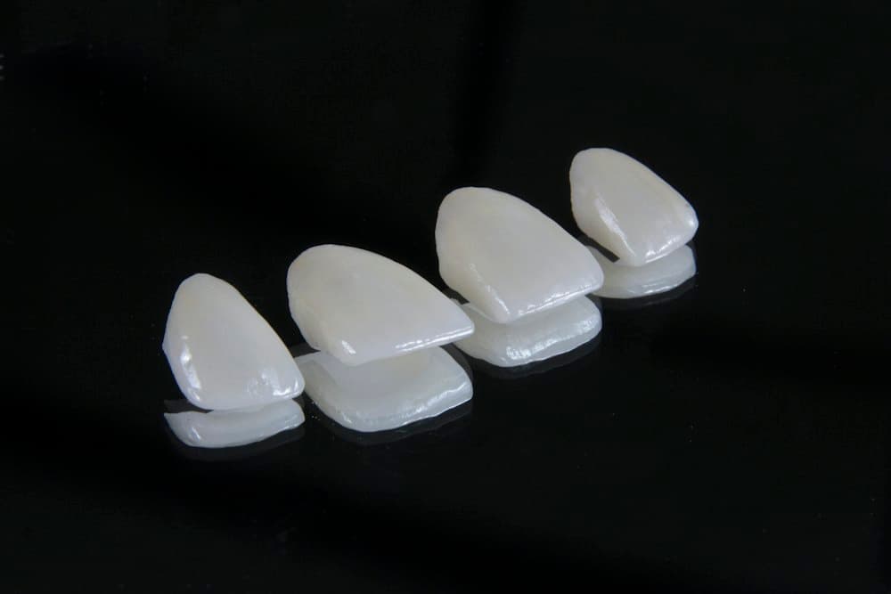 Bốn mặt dán sứ đặt trên nền tối